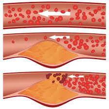 Како смањити холестерол у крви: савети и трикови