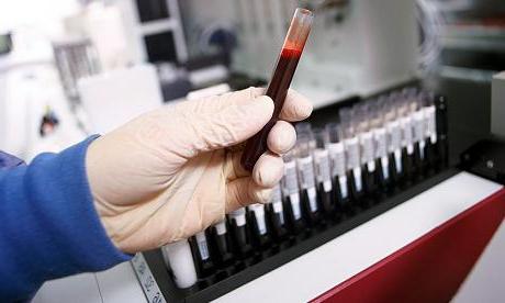 Шта сигнал теста крви уколико су АЛТ и АСТ повишени?